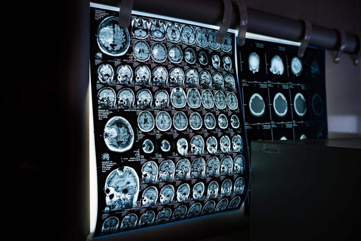 A importância do raio X para diagnósticos: saiba tudo