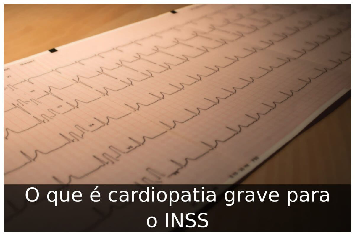 O que é cardiopatia grave para o INSS